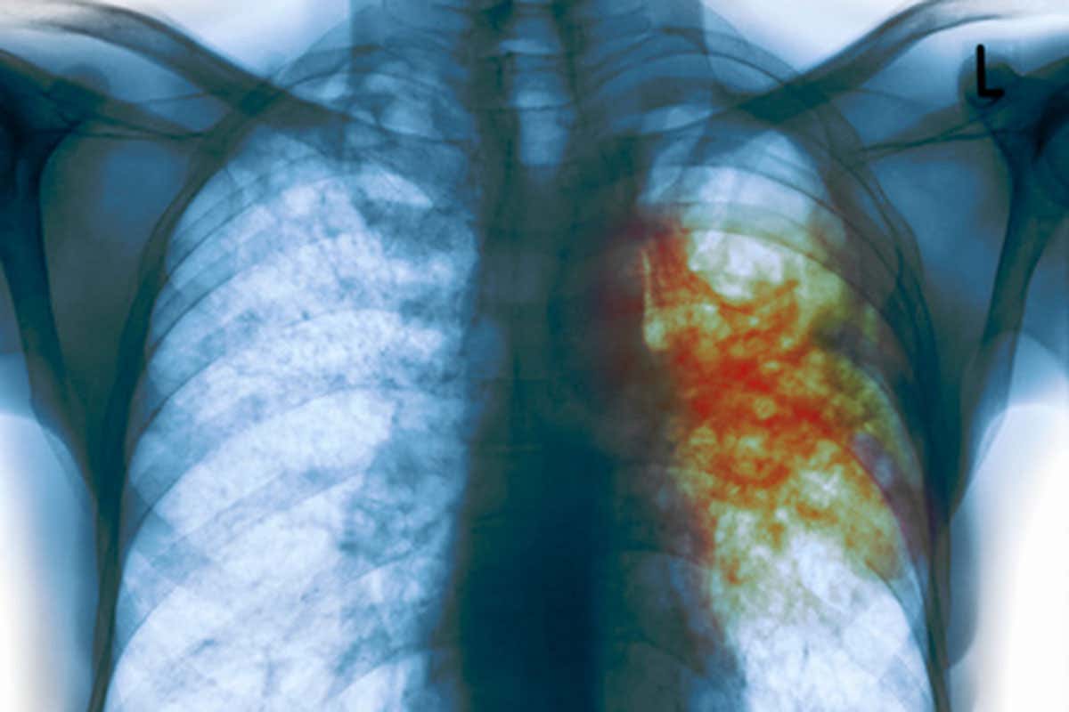 New Scientist. Science news and long reads from expert journalists, covering developments in science, technology, health and the environment on the website and the magazine.