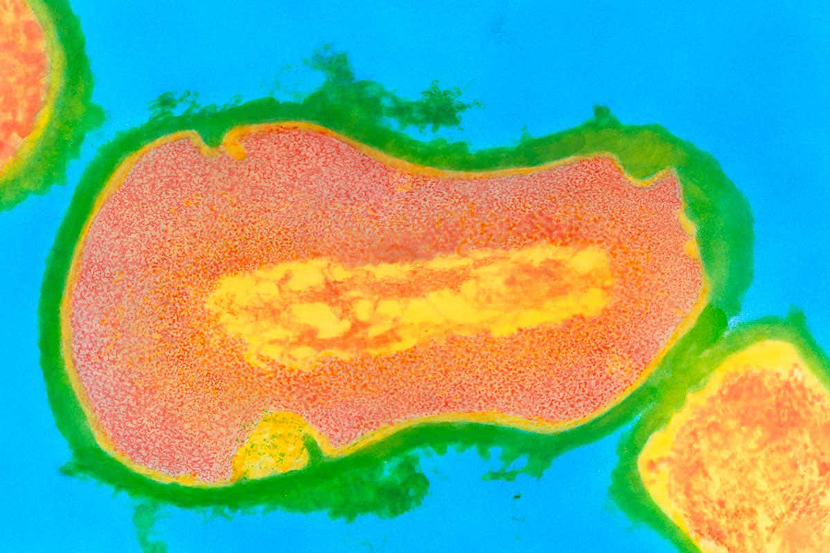 Propionibacterium acnes, which causes acne