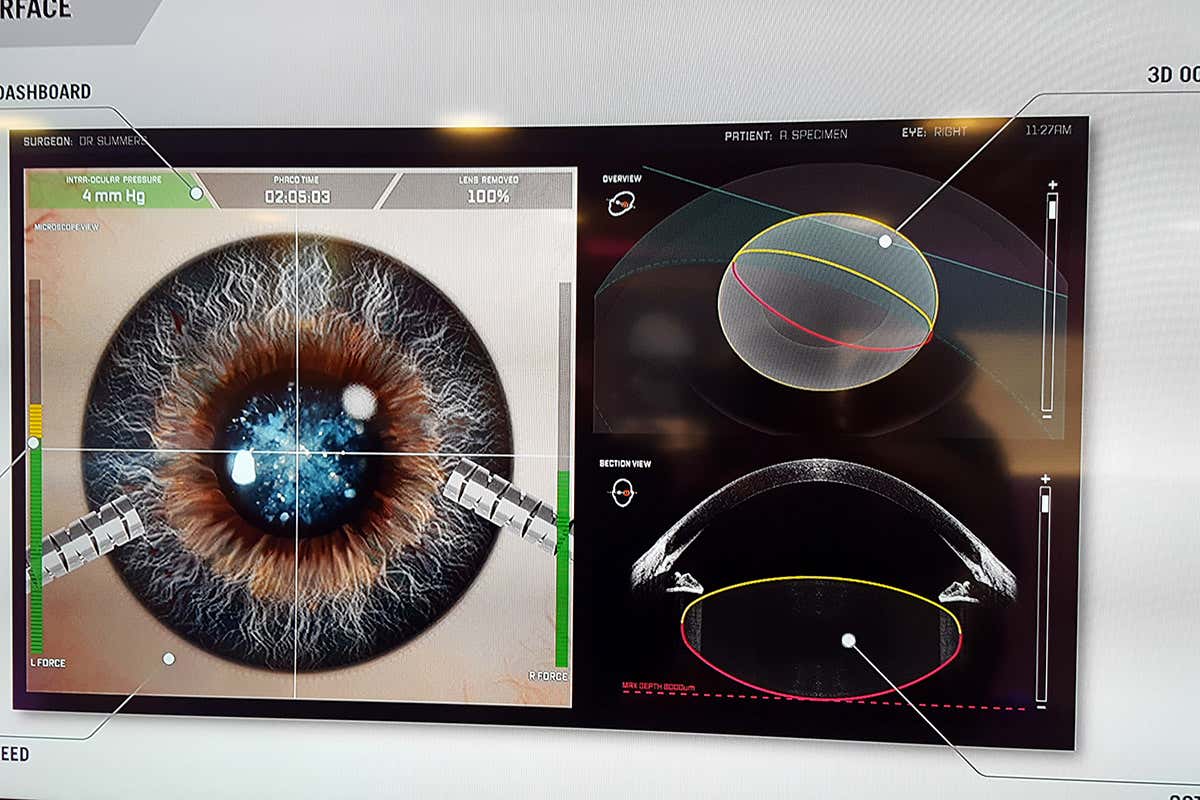 Screen showing a detailed view of the procedure