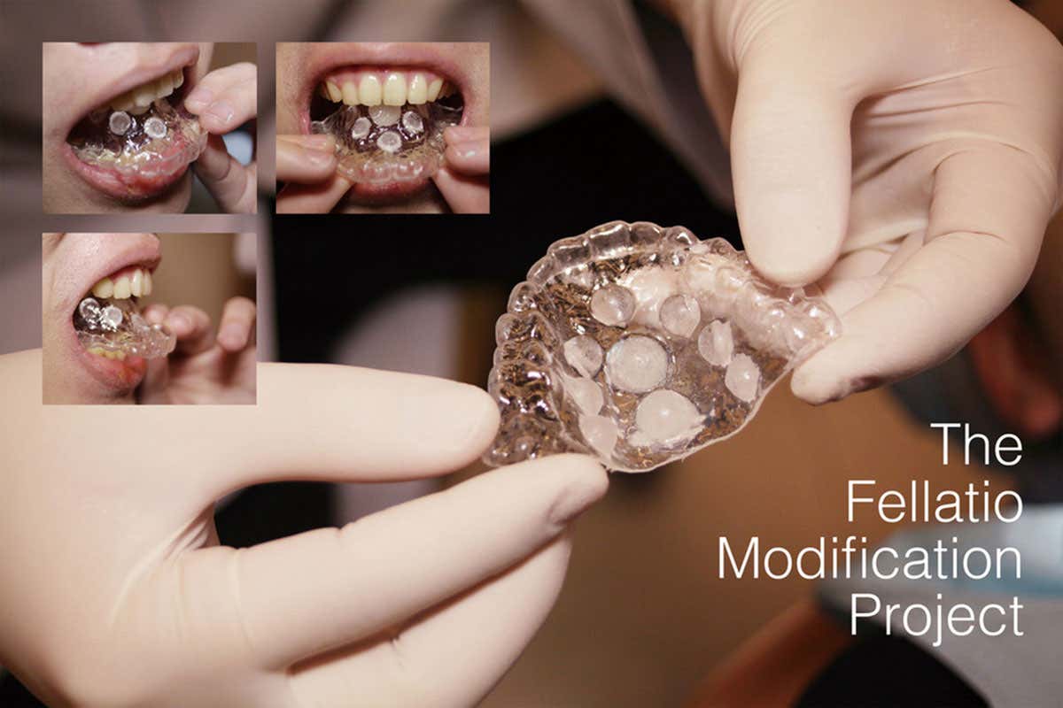 A close-up of a completed oral sex prosthetic retainer