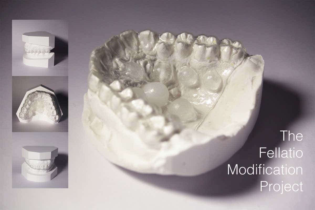 A close-up of the retainer on a plaster case of someone's teeth and mouth