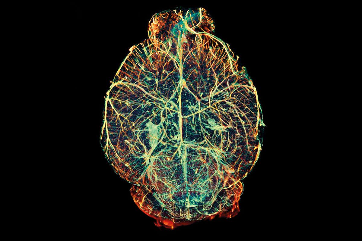 Blood vessels of healthy mouse brain