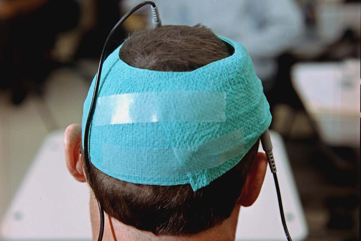 Transcranial direct current stimulation (tDCS) uses electrodes to send a current across the brain