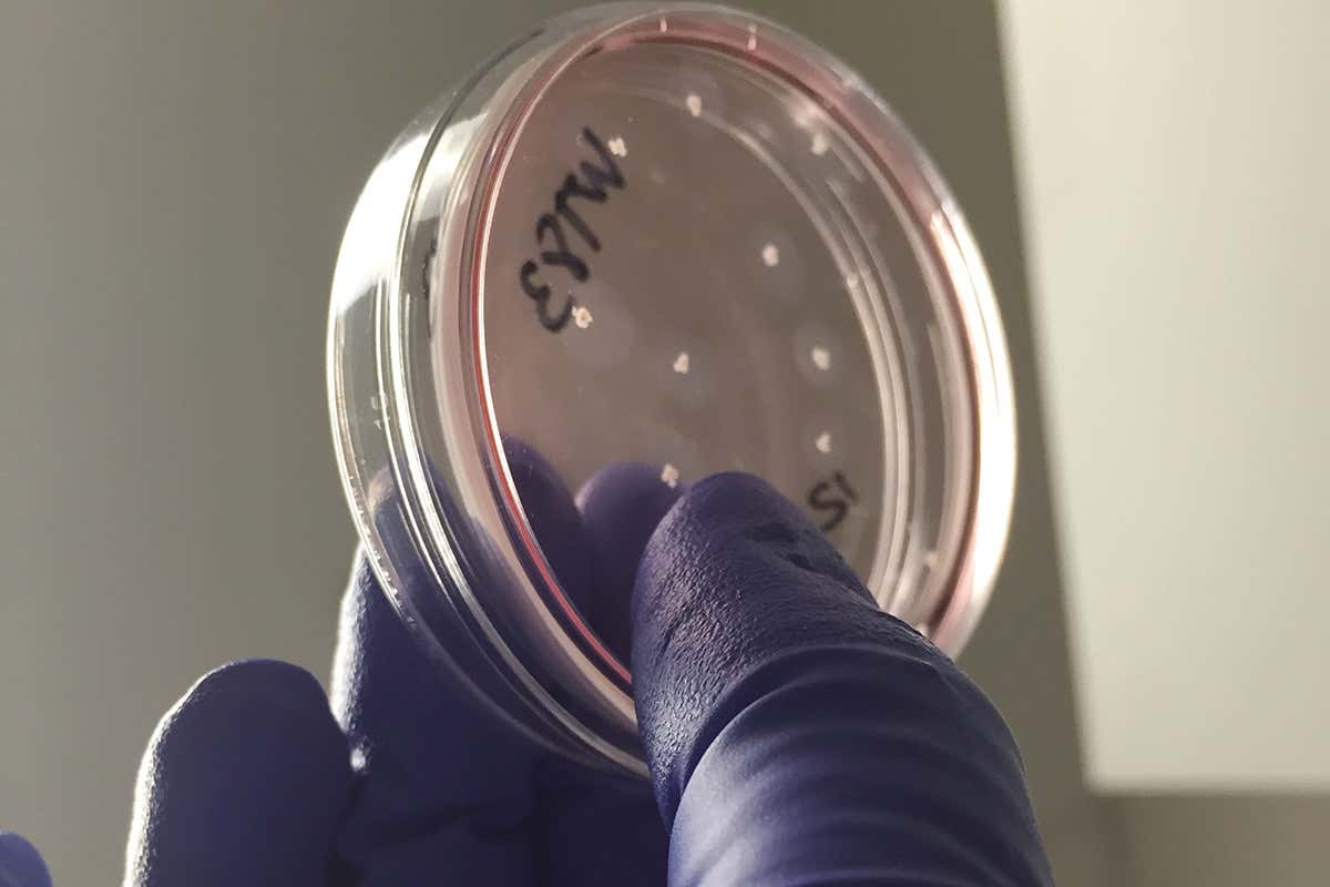 Gloved hand holding glass dish containing little balls of tissue