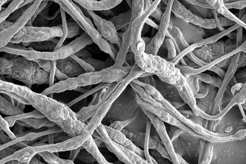 SEM image of the TPP@PVDF-HFP microfibers. Scale bar, 5 μm.