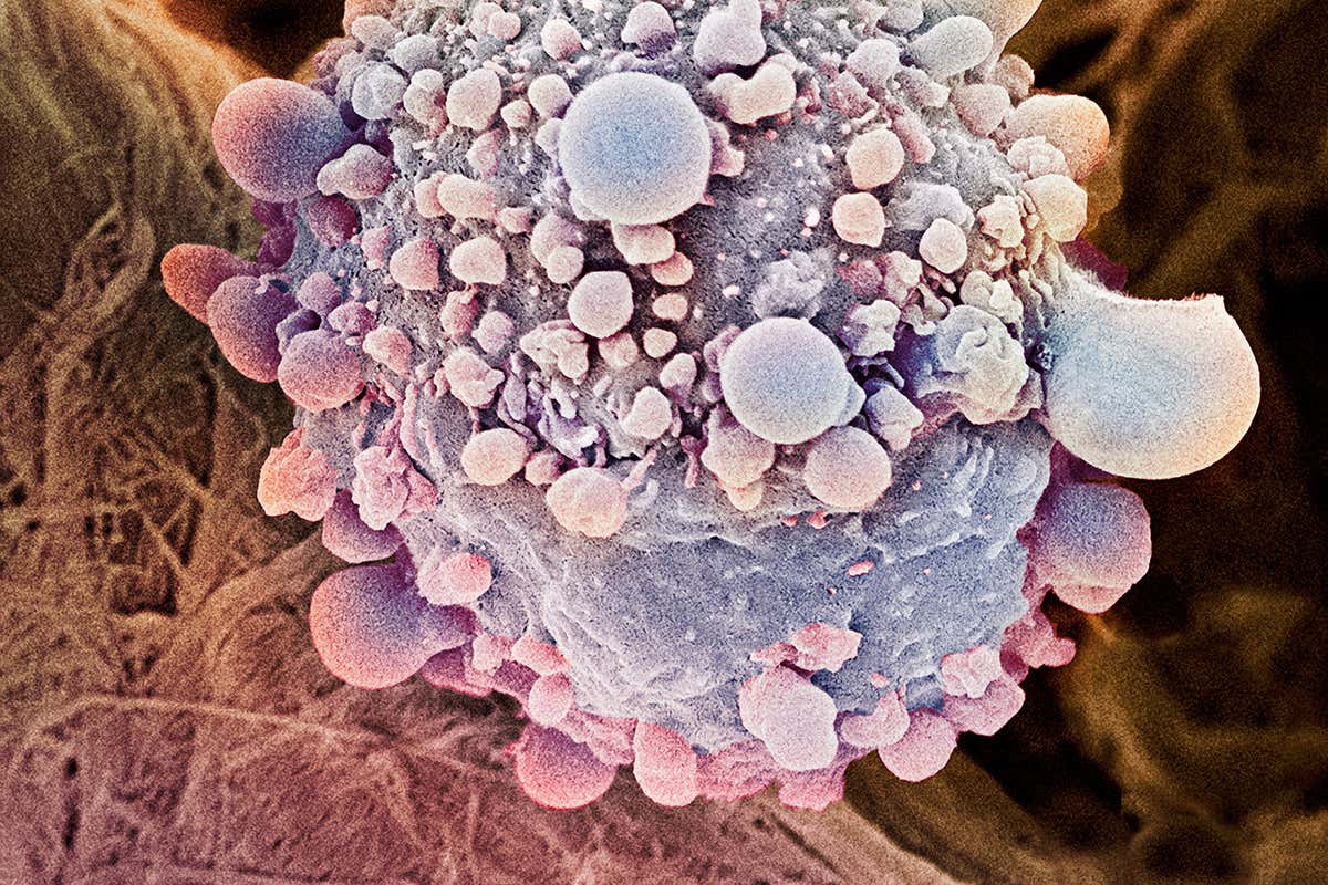 A pancreatic cancer cell