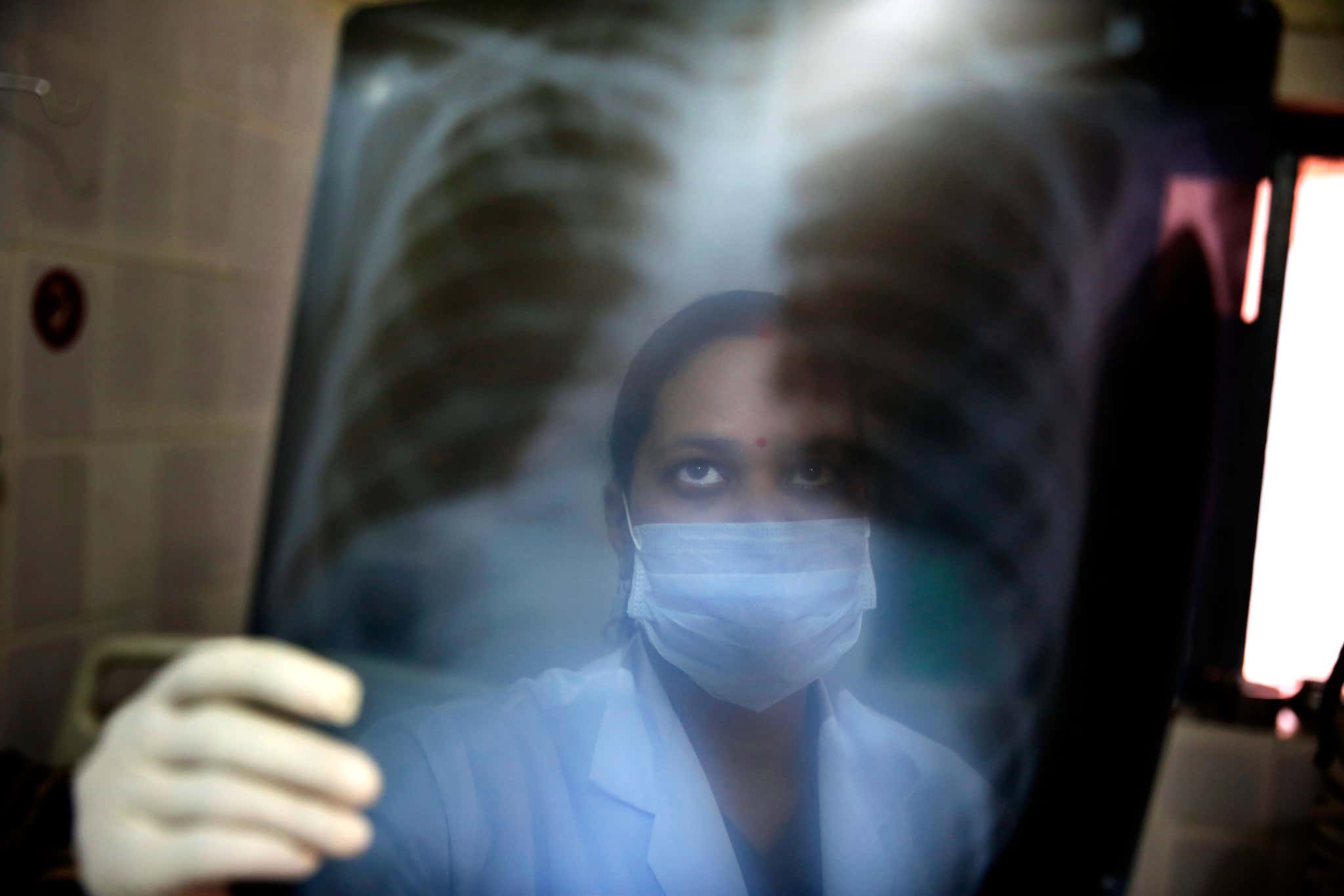 Woman holding up chest X-ray
