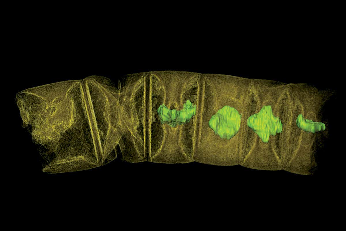 New Scientist. Science news and long reads from expert journalists, covering developments in science, technology, health and the environment on the website and the magazine.