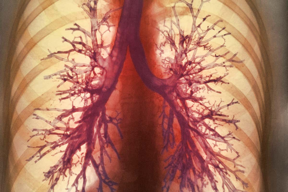 Medical image of the airways in a pair of lungs