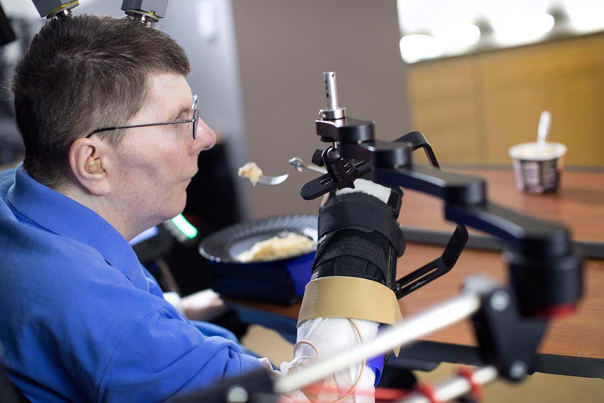 Bill Kochevar can feed himself thanks to a neuroprosthesis