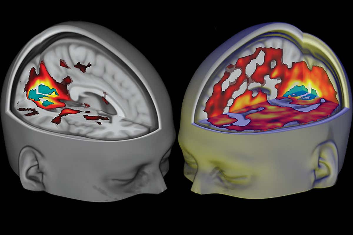 Models of brain activity