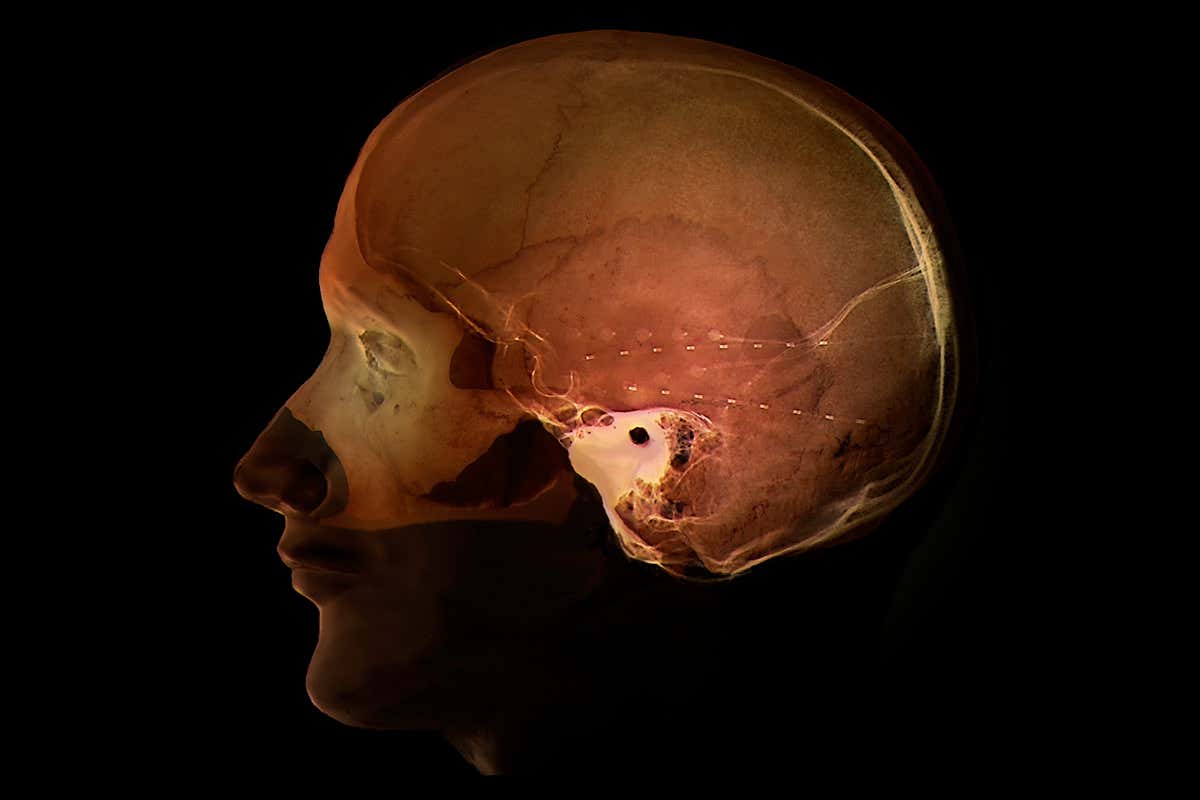 Location of electrode in the brain