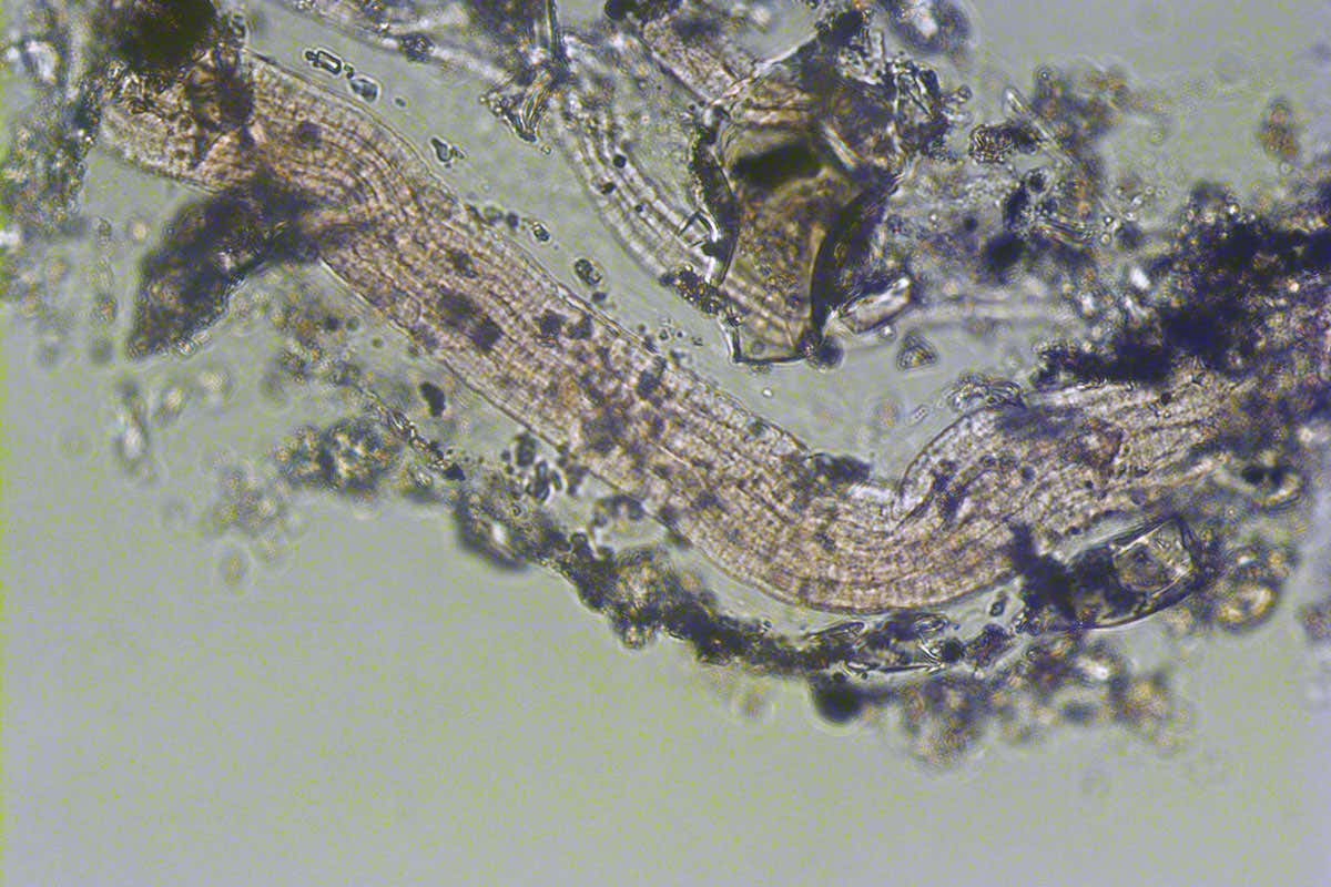 A white strand of a hair-like bacterium