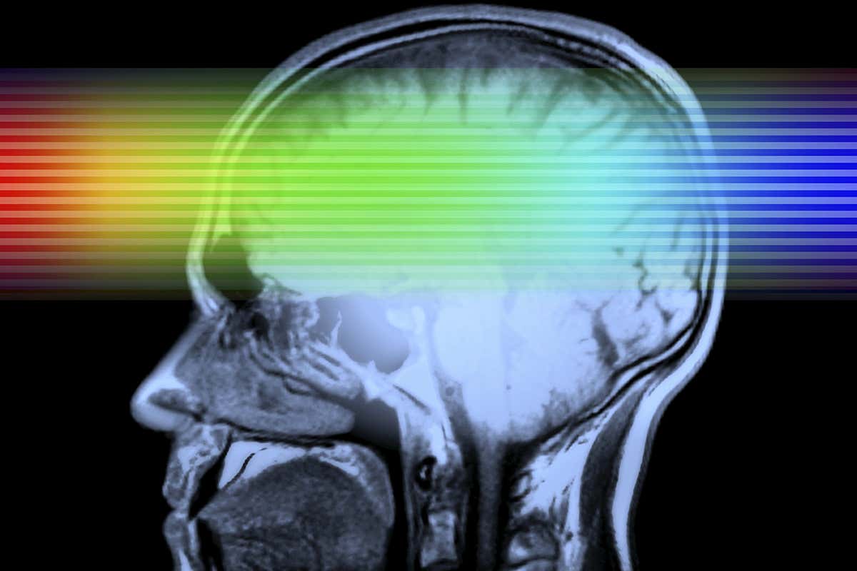 Rainbow light passing through brain scan