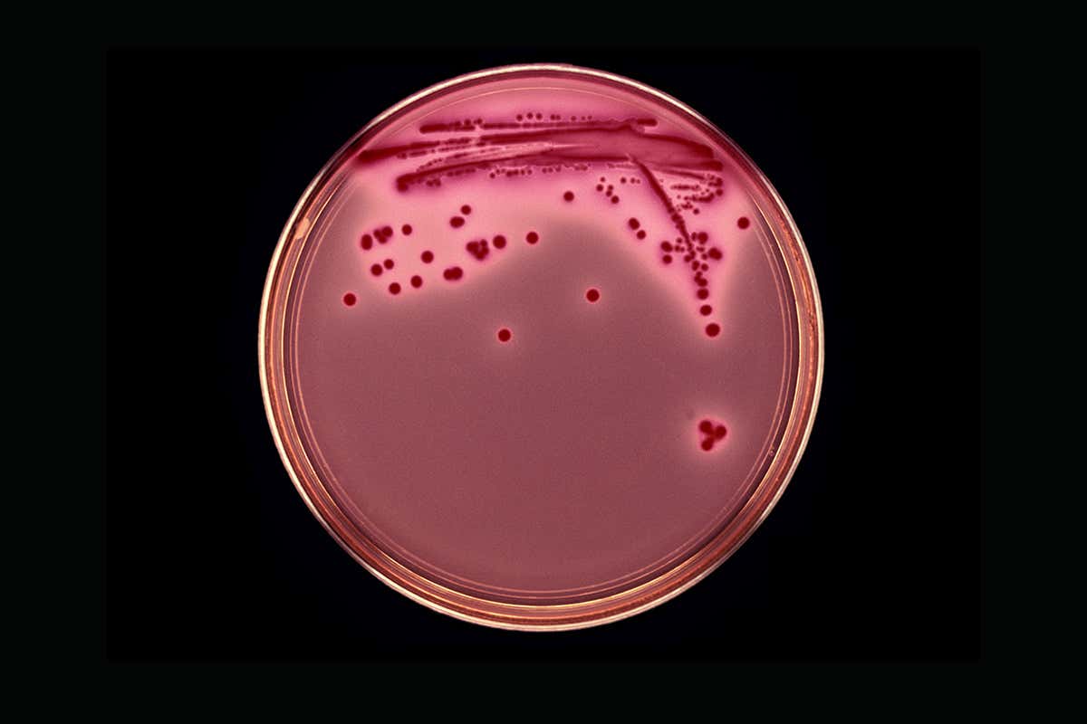 E. coli colonies