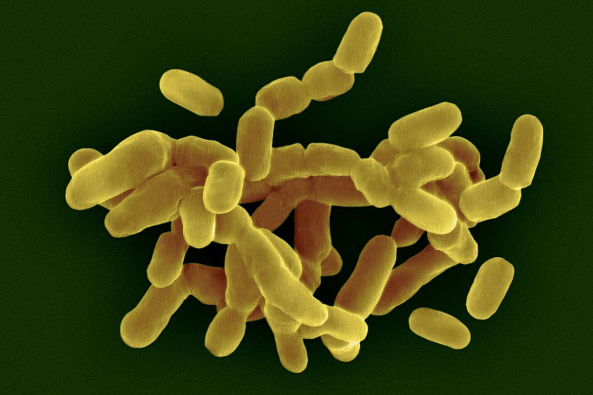 Gardnerella vaginalis that causes bacterial vaginosis