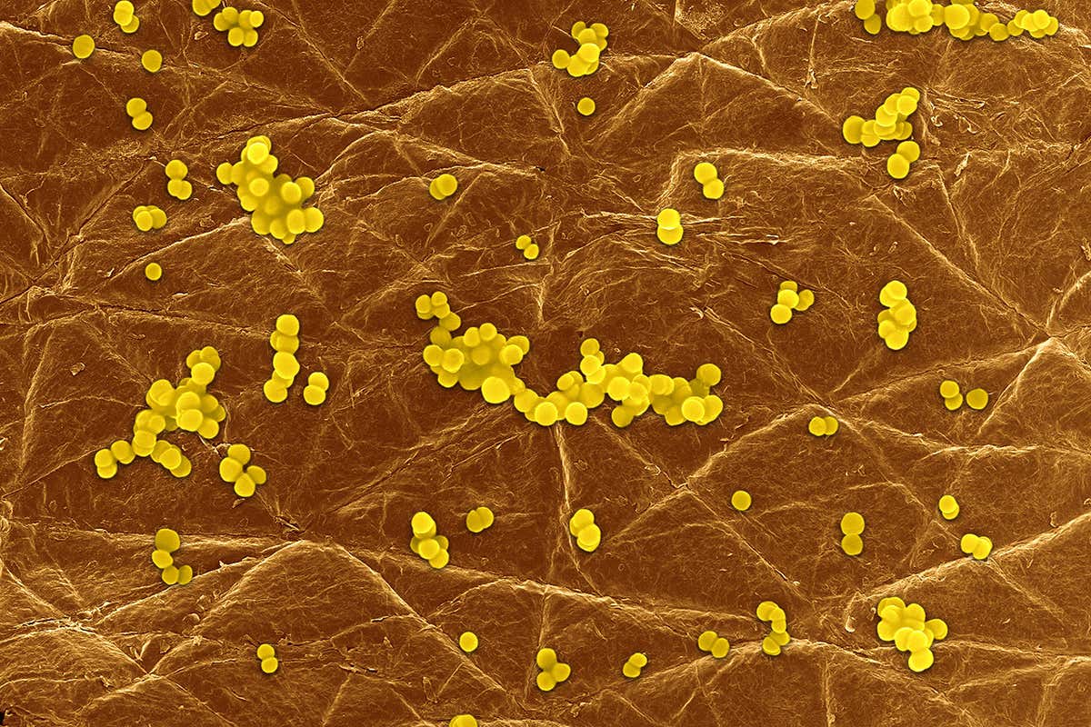 Staphylococcus aureus on human skin