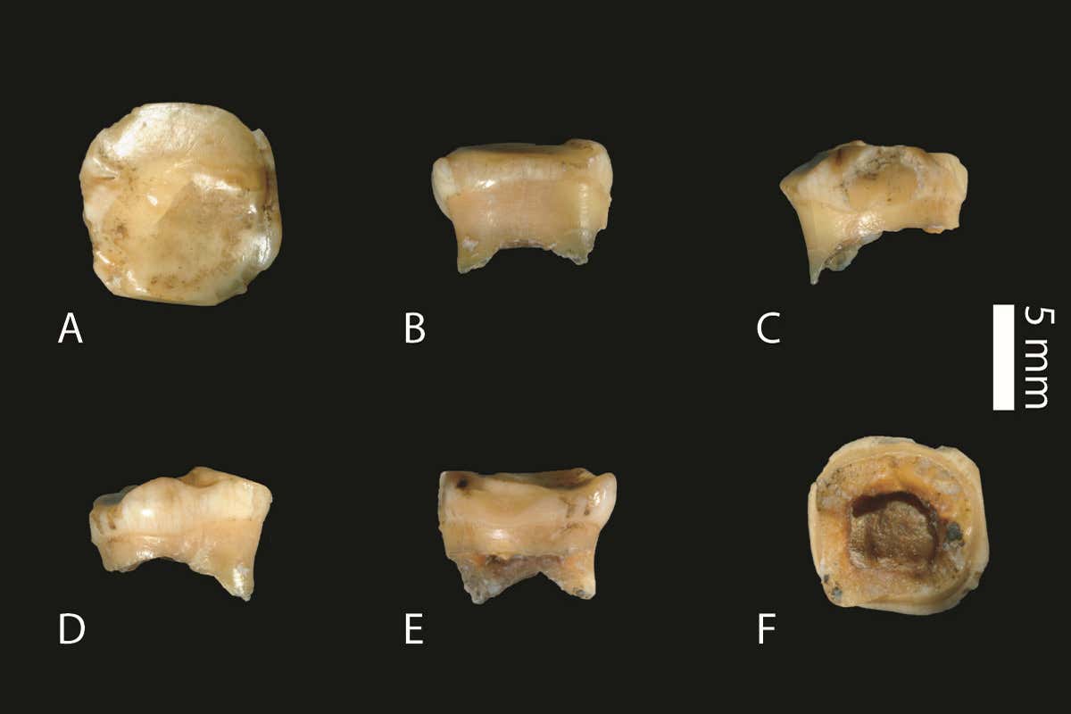 Views of the milk tooth, a molar