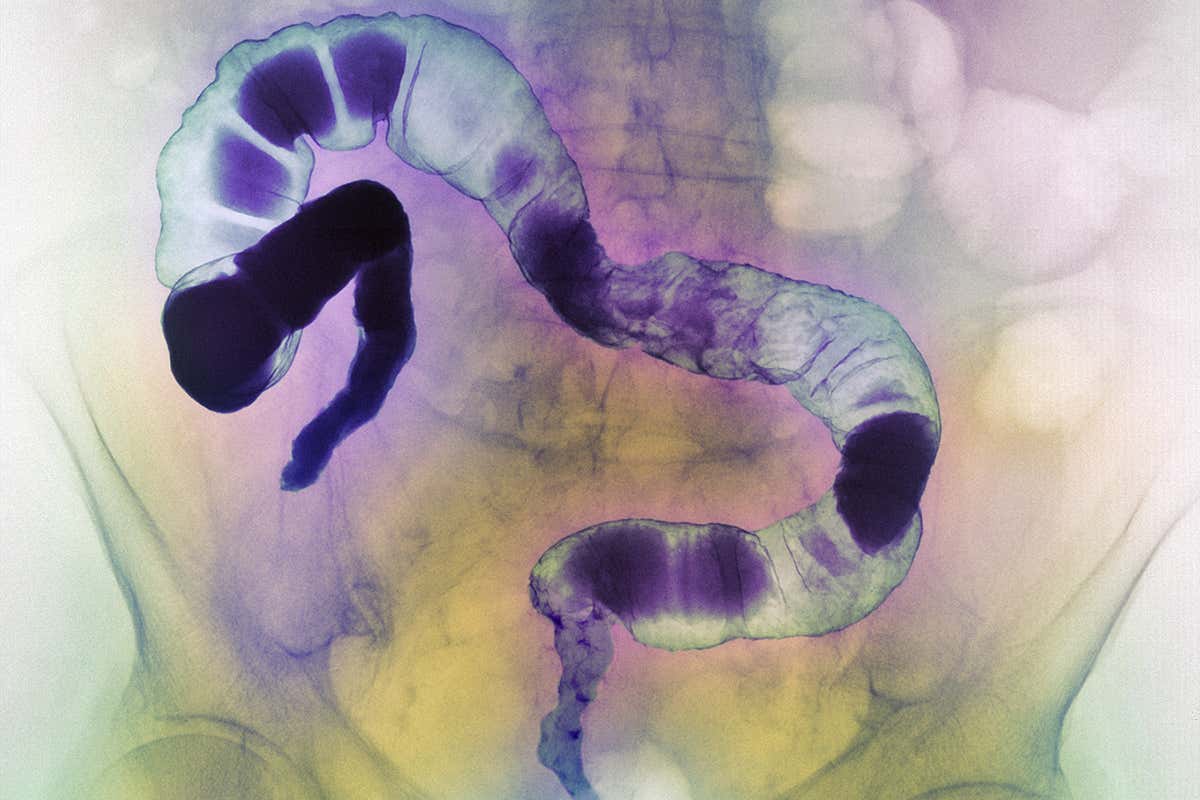 New Scientist. Science news and long reads from expert journalists, covering developments in science, technology, health and the environment on the website and the magazine.