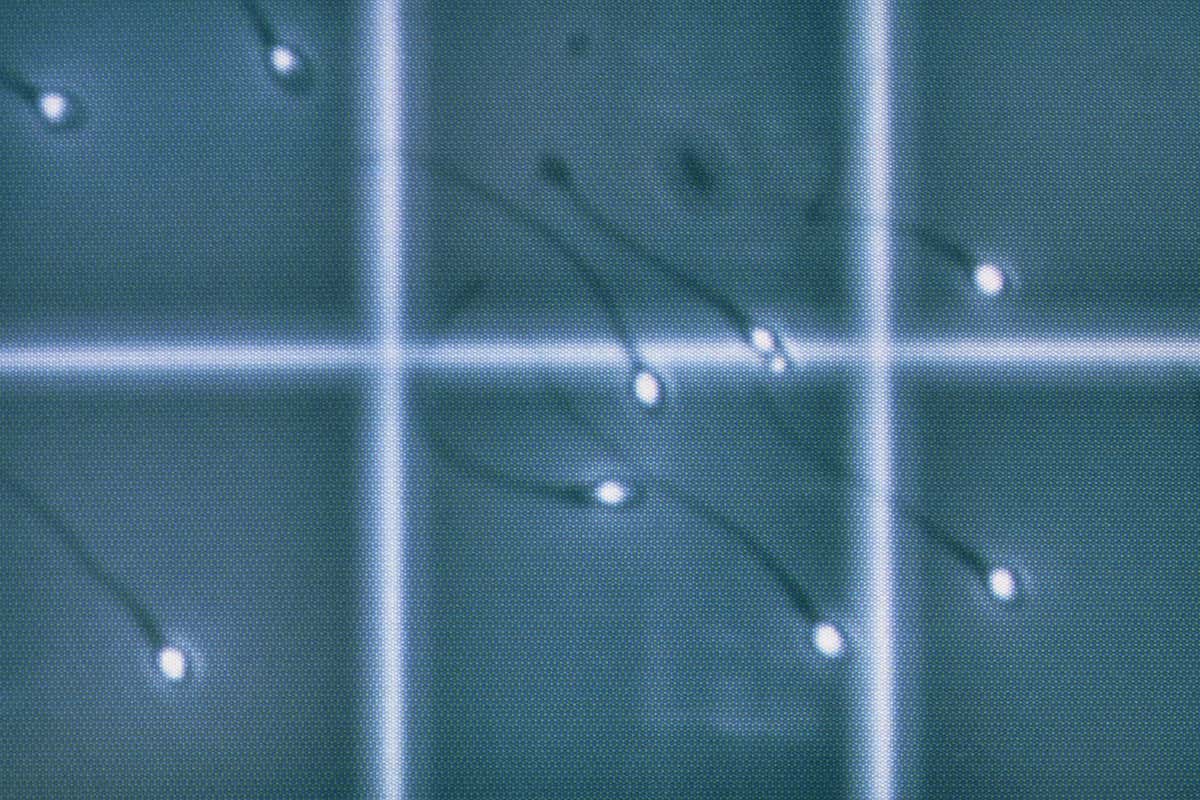 Sperm being counted