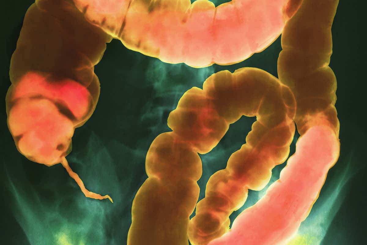 False-colour x-ray of the abdomen showing the large intestine (colon)