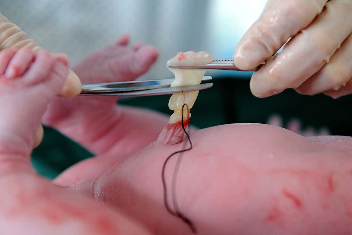 umbilical cord