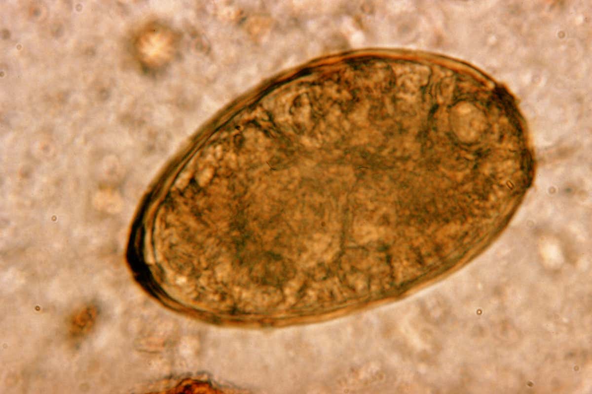 Egg of the Paragonismus westermani fluke