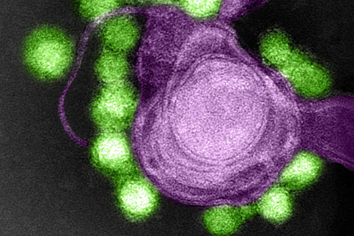 We may be able to use Zika virus to attack brain cancer cells