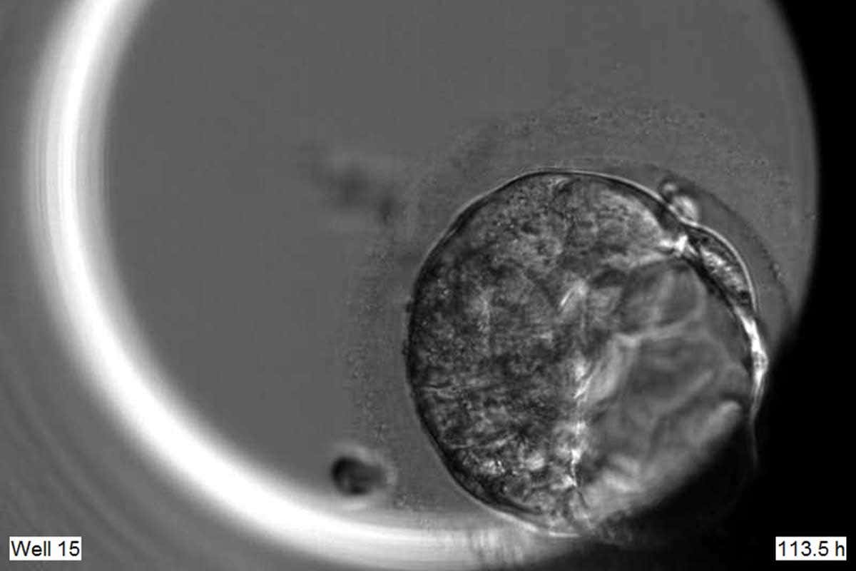 CRISPR-edited embryo