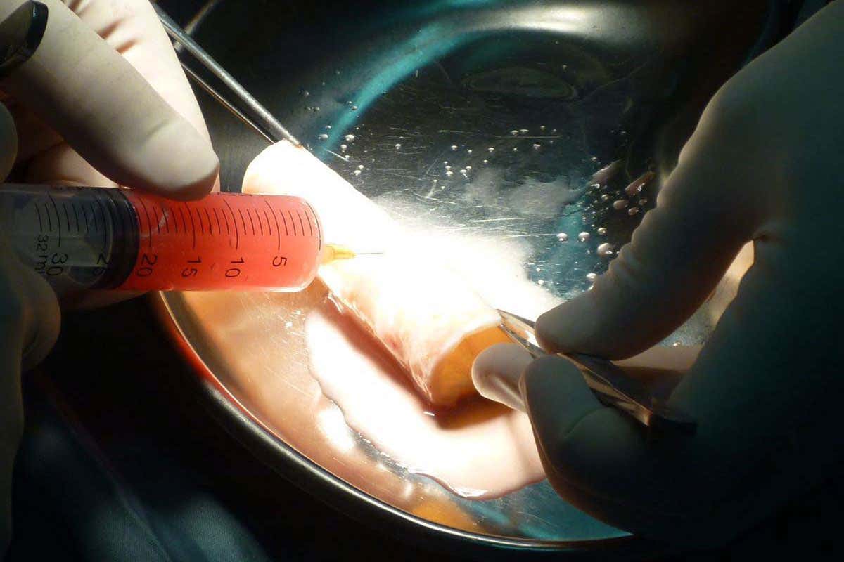 Artificial organs used in operations without approval for humans