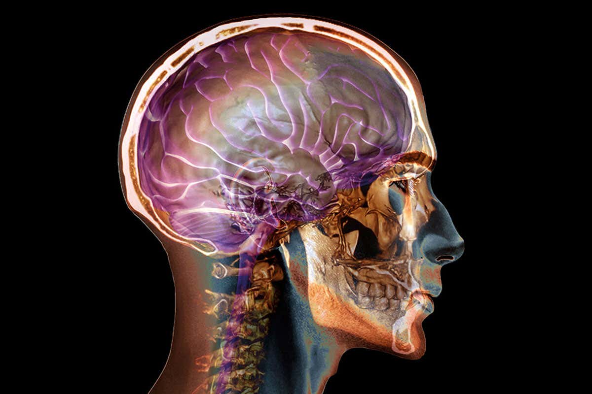 Our braininess may have evolved thanks to less sticky neurons