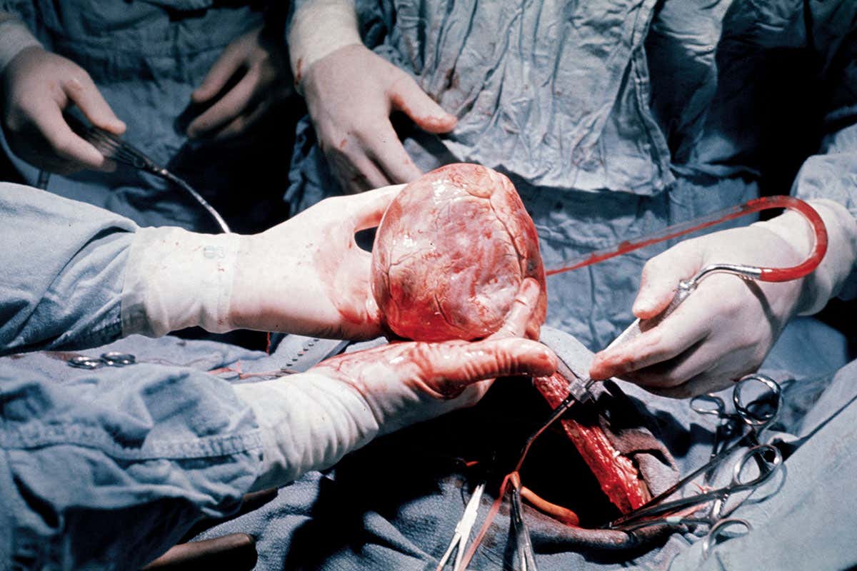 Heart in operating theatre