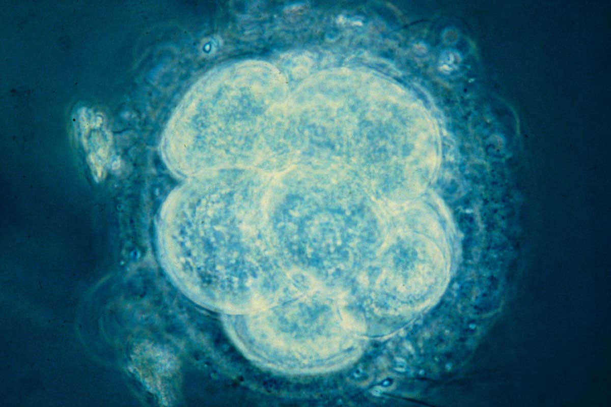 An early embryo