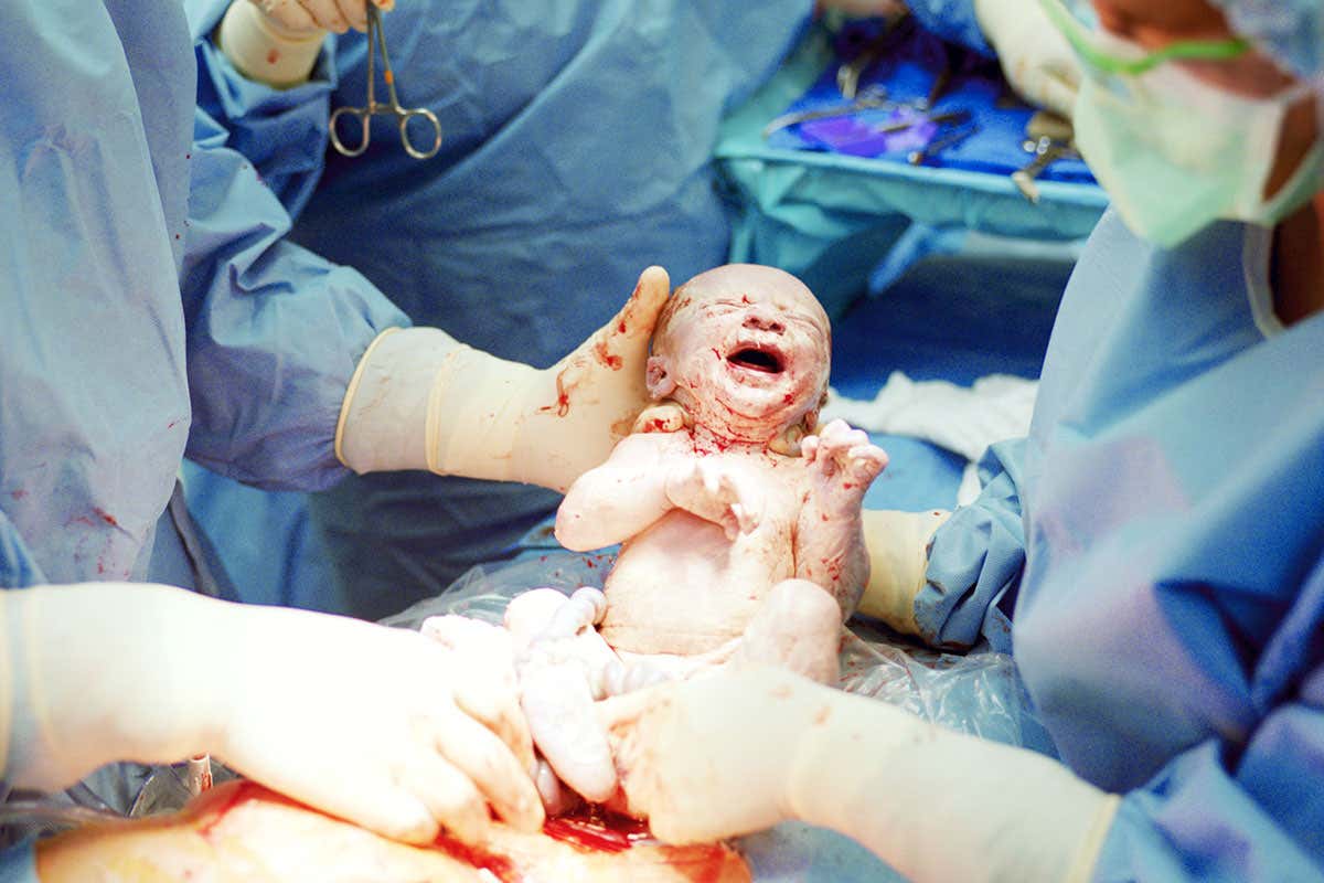 A baby being born by C-section