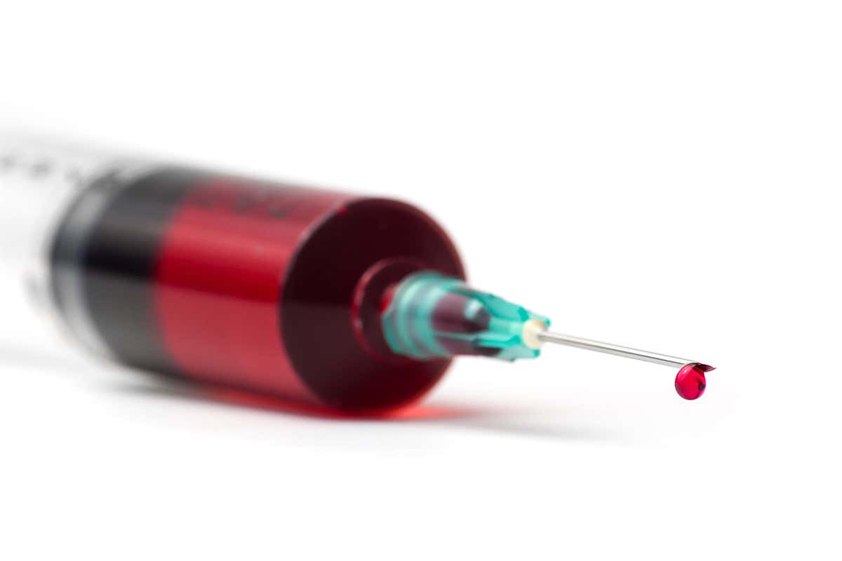 First results from young blood Alzheimer’s trial are criticised