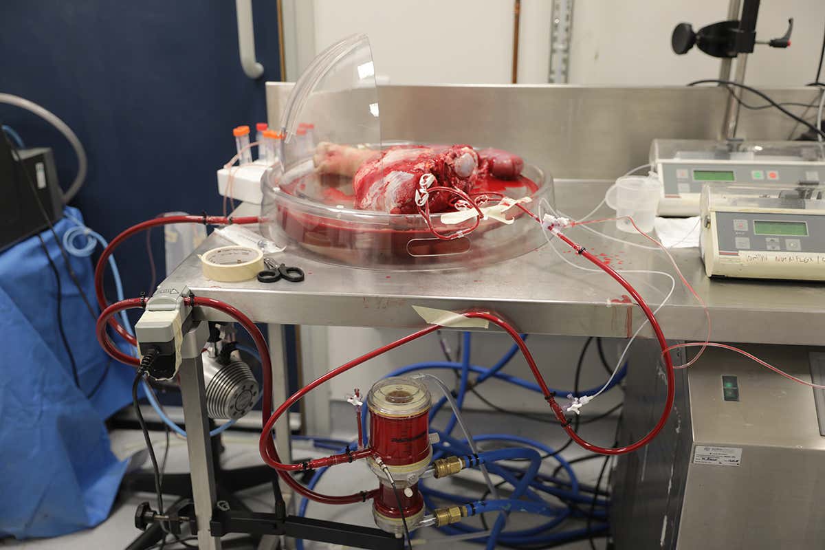Welcome to the limb lab where organs are kept alive on shelves