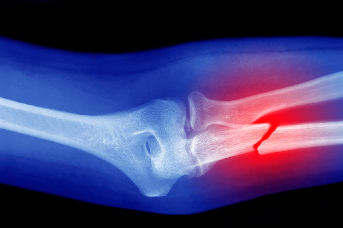 A family in Italy doesn’t feel pain because of a gene mutation