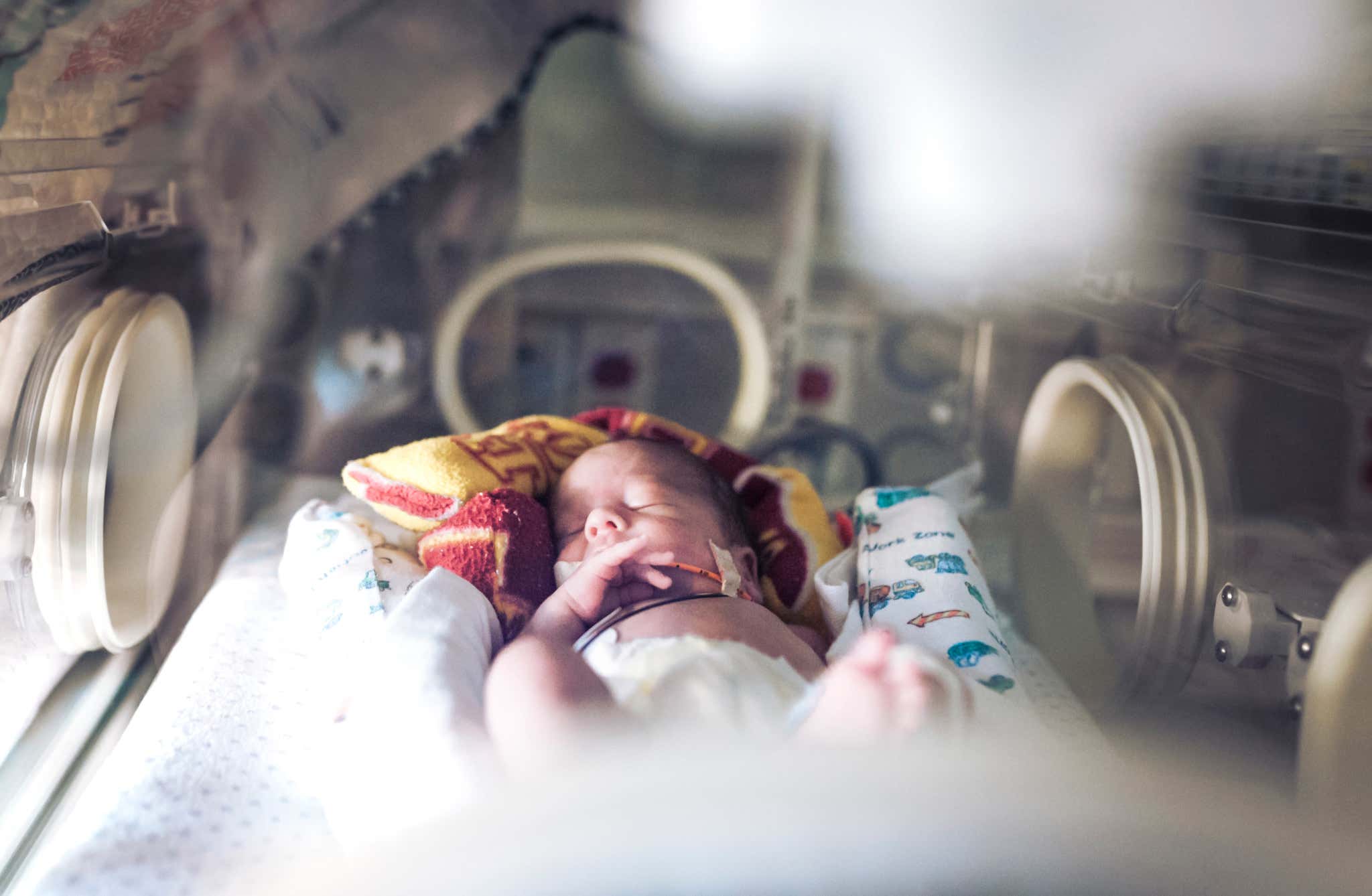 An underweight newborn baby