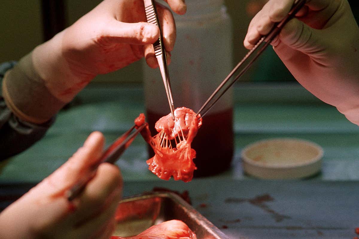 Preparing a heart valve for storage