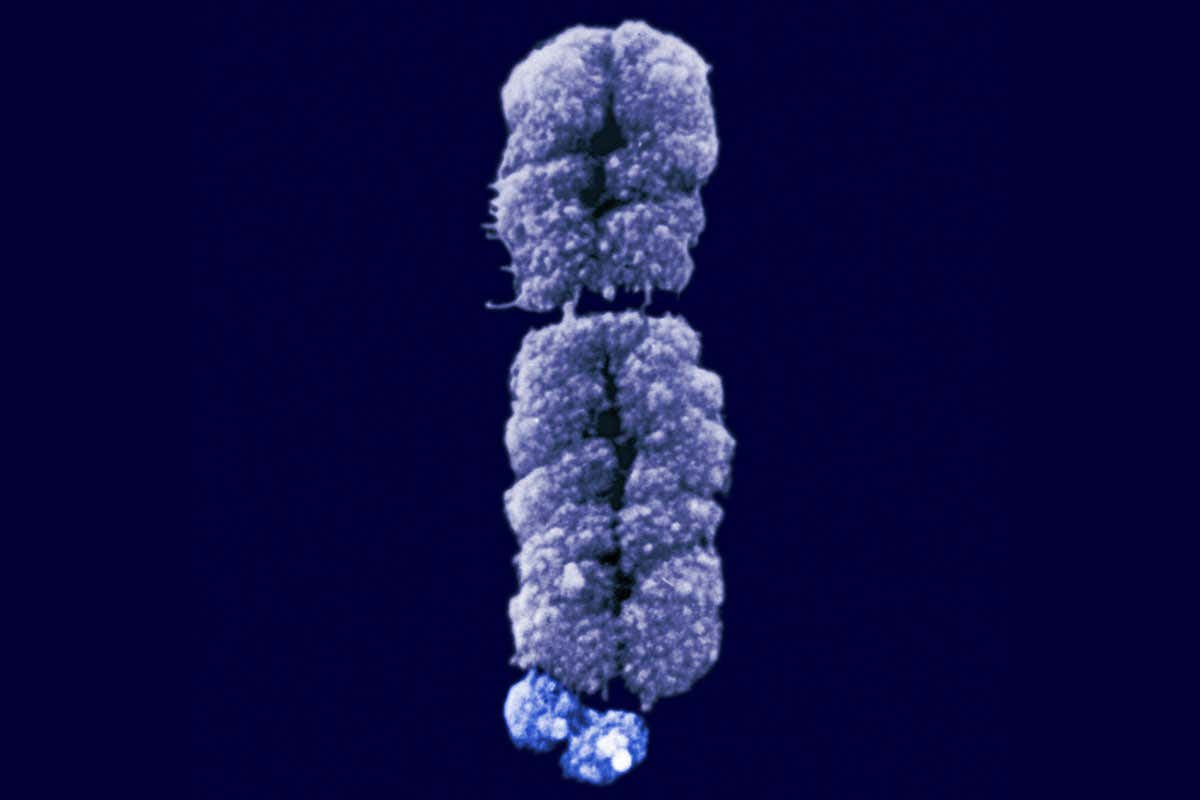 An X chromosome from someone with fragile X syndrome