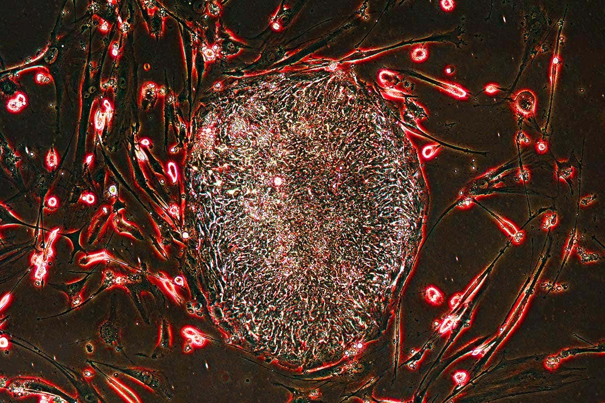 Stem cells zapped with radiation can protect mice from cancer