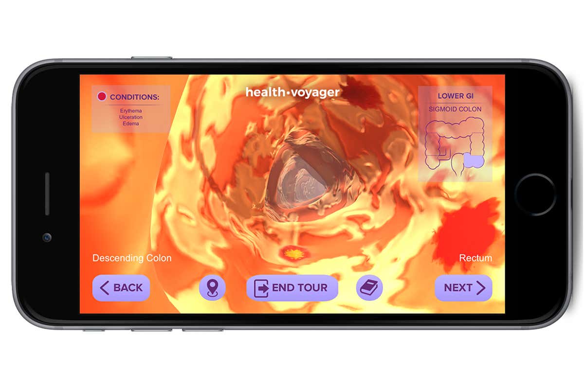 Virtual reality lets doctors guide you through your own guts