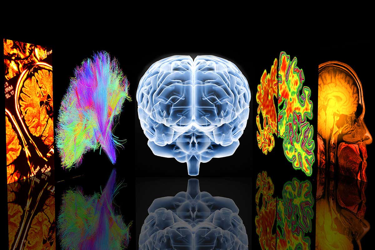 Artwork showing different ways of visualising the brain