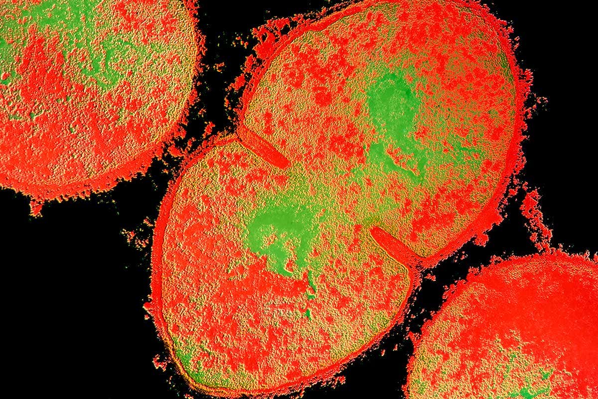 Skin spray heals US woman's flesh-eating bacteria wounds