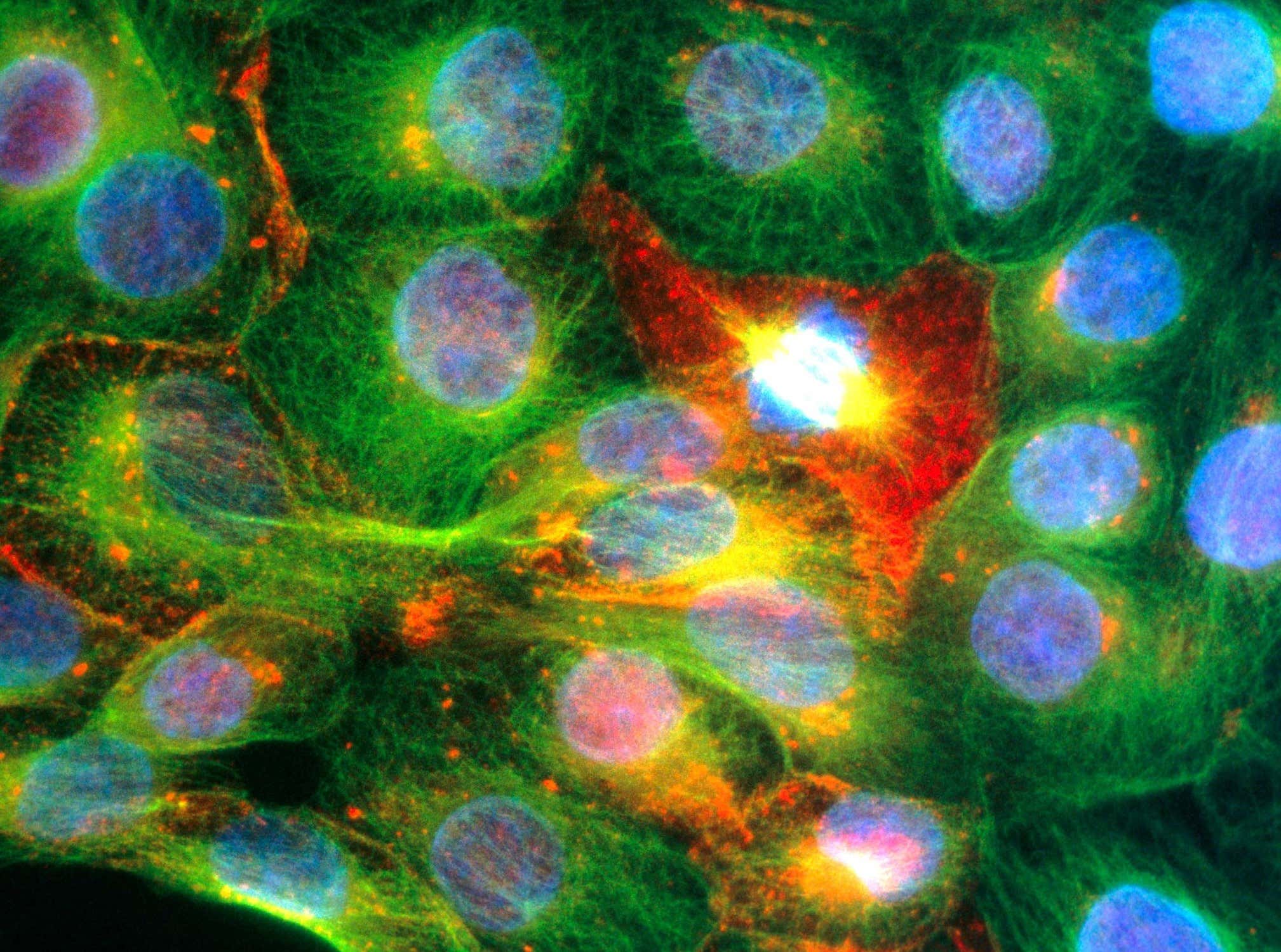 Prostate cancer cells