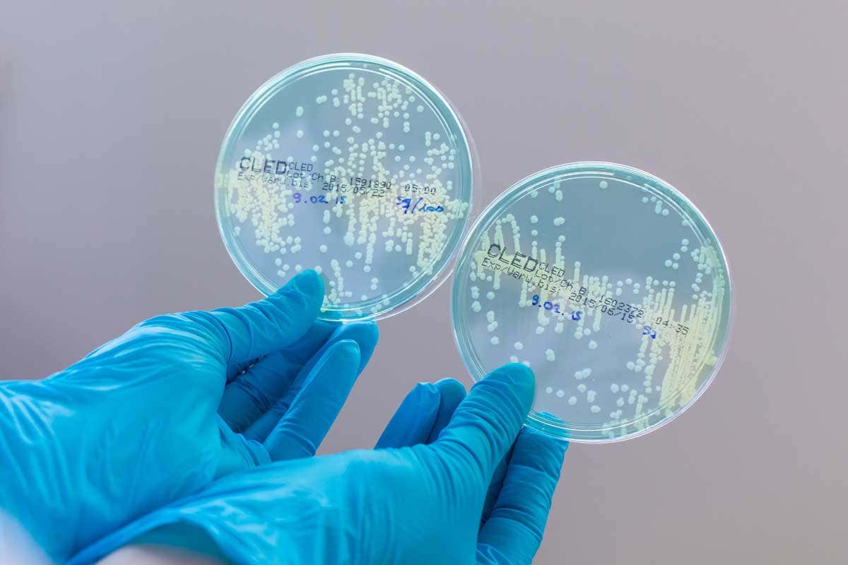 Resistant bacteria growing in petri dishes