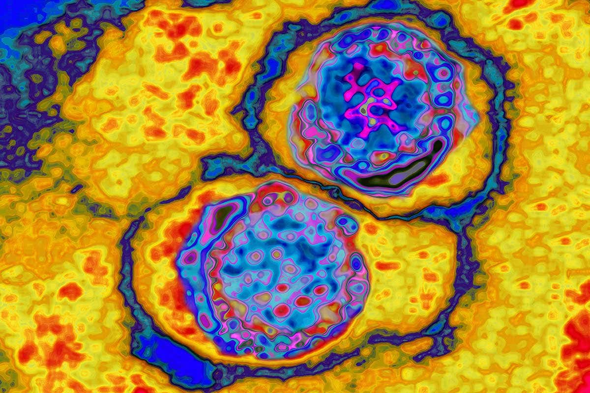 New Scientist. Science news and long reads from expert journalists, covering developments in science, technology, health and the environment on the website and the magazine.