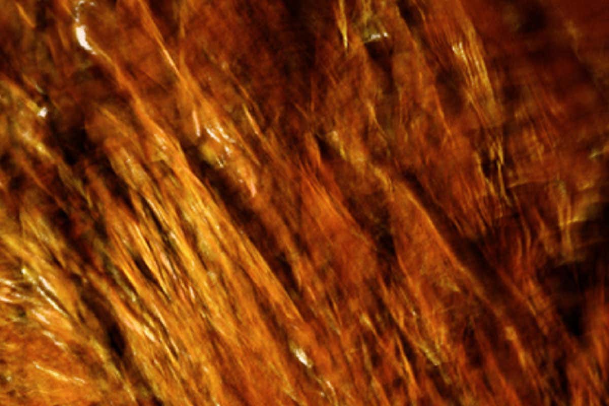 3D image of bone structure