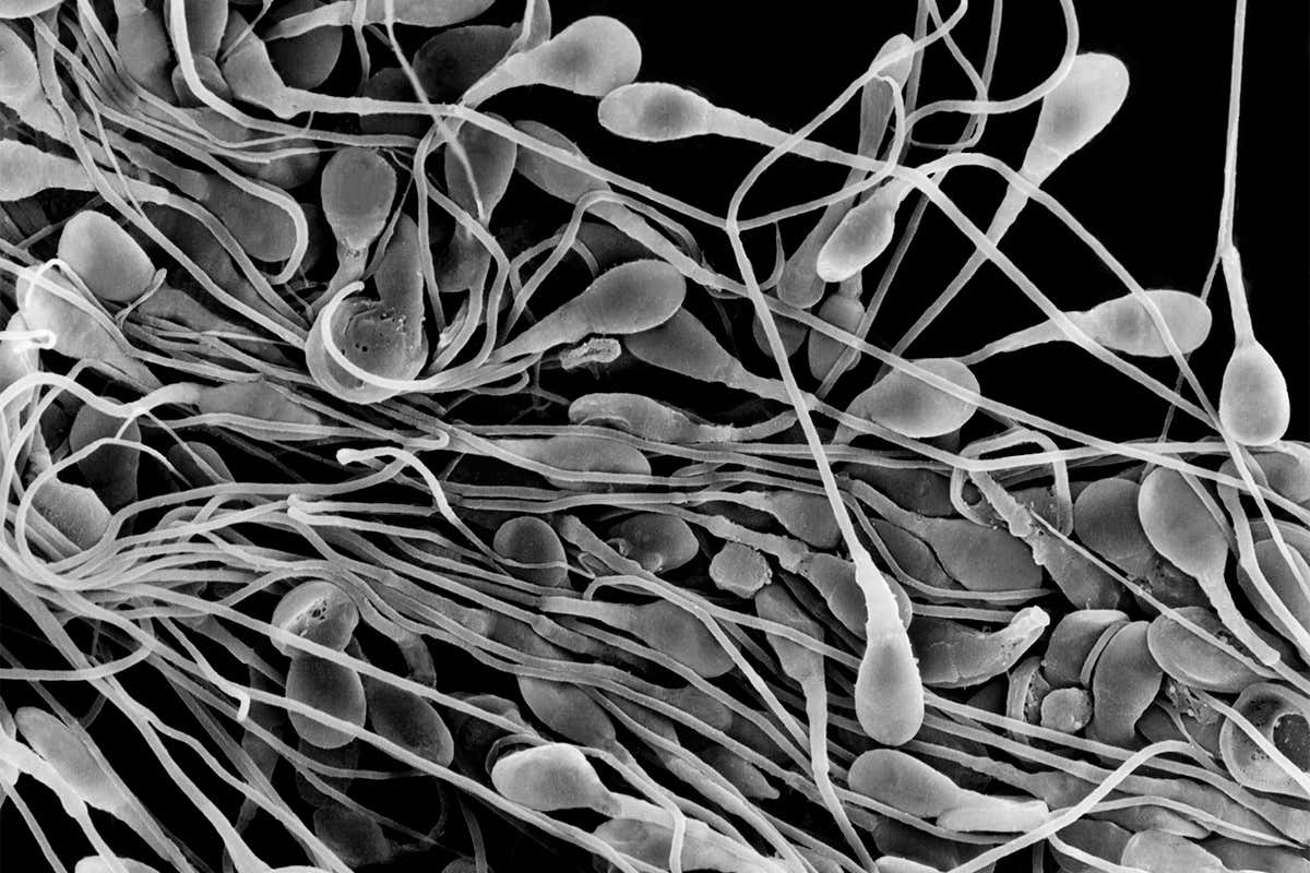 Micrograph of sperm