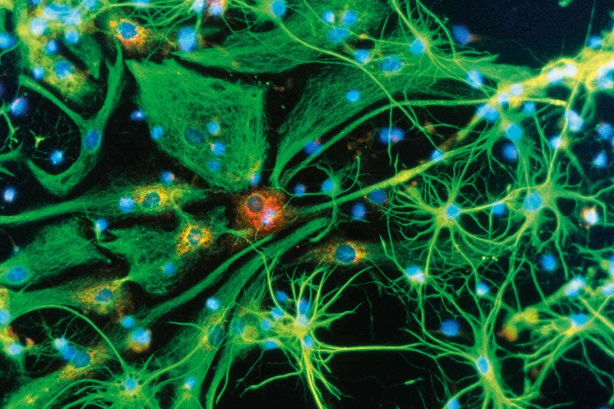 Brains grow brand new neurons after experimental drug injection